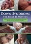 Down Syndrome: The First 18 Months