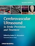 Cerebrovascular ultrasound in stroke prevention and treatment