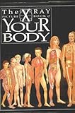 The X ray picture book of your body