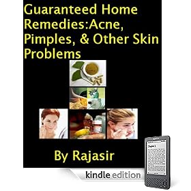 Guaranteed Home Remedies to Cure Acne