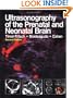 Ultrasonography of the Prenatal &  Neonatal Brain