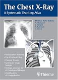 The Chest X Ray: A Systematic Teaching Atlas