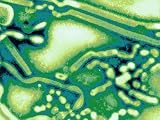 Virus Influenza Types A or B Viruses Cause Epidemics of Disease Almost Every Winter Photographic Poster Print, 32x24