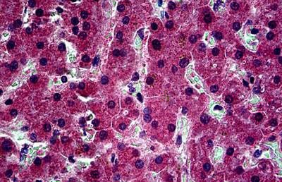 Rabbit Polyclonal (IgG) to Human MMP2 (Antibody)