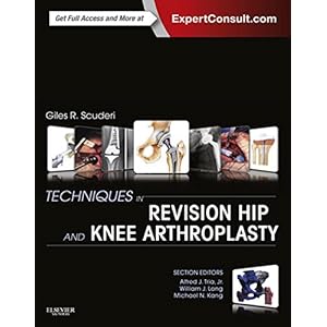Techniques in Revision Hip and Knee Arthroplasty: Expert Consult