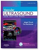 Vascular Ultrasound: How, Why and When, 3e