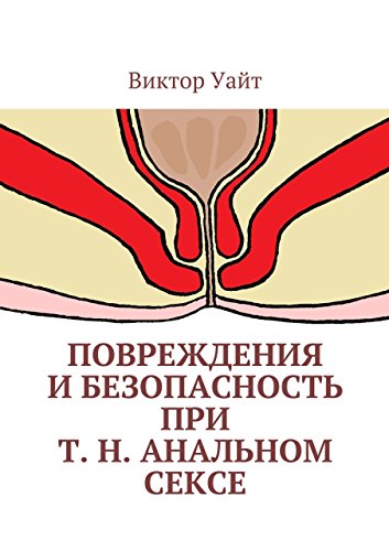 Повреждения и безопасность при т. н. анальном сексе (Russian Edition)