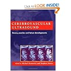 Cerebrovascular Ultrasound: Theory, Practice and Future Developments by Michael G. Hennerici and Stephen P. Meairs