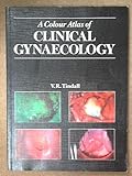 A colour atlas of clinical gynaecology