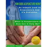 How Does Acupuncture Work? An Indepth Look At Acupuncture And It's Evolution (What Is Acupuncture & How Can It Help Me?)
