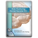 BrainMonitoring:NormalNeonatalEEG