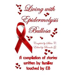 Living with Epidermolysis Bullosa