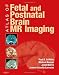 Atlas of Fetal and Postnatal Brain MR, 1e