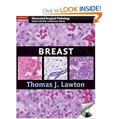 Breast (Cambridge Illustrated Surgical Pathology) by Thomas J. Lawton