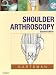 Shoulder Arthroscopy