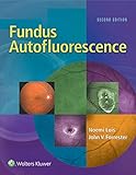 Fundus autofluorescence