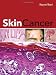 51 KXwR6XgL. SL75  Skin Cancer
