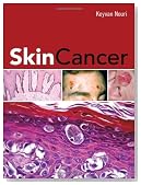 Skin Cancer