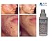 SILICON & COLLAGEN Topical Spray Acne Scars Facial Wrinkles & Age Blemishes 4 oz