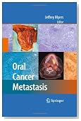 Oral Cancer Metastasis