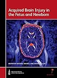 Acquired brain injury in the fetus and newborn