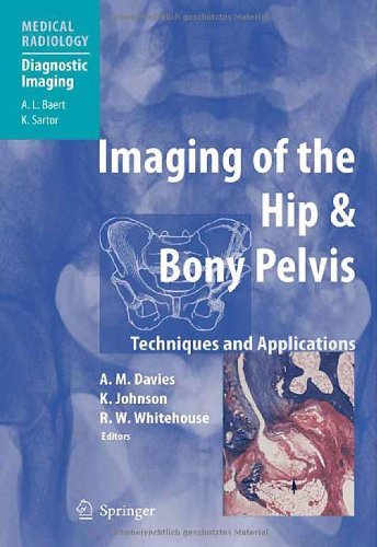 Imaging of the Hip & Bony Pelvis (Medical Radiology)