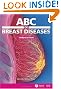 ABC of Breast Diseases (ABC Series)