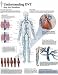 Book Understanding Dvt