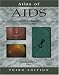 Atlas of AIDS (Atlas of Infectious Diseases (Mandell))