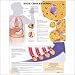 High Cholesterol Anatomical Chart