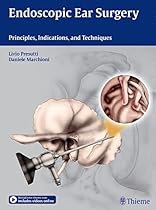 Endoscopic Ear Surgery: Principles, Indications, and Techniques Endoscopic Ear Surgery: Principles, Indications, and Techniques