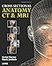 Cross Sectional Anatomy CT & MRI