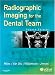 Books : Radiographic Imaging for the Dental Team