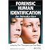 Forensic Human Identification: An Introduction