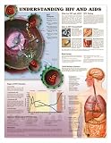 Chart - Understanding HIV and AIDS