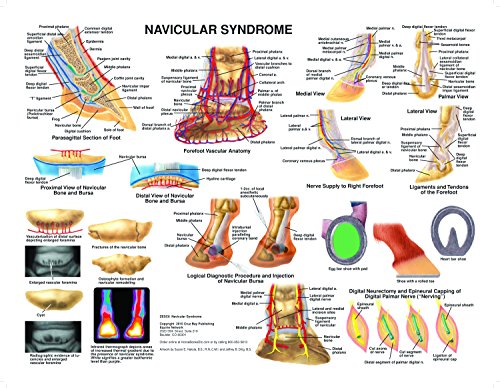 Equine Navicular Syndrome Anatomy Chart