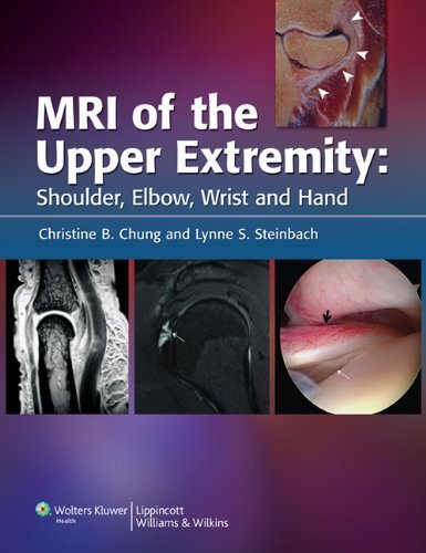 MRI of the Upper Extremity: Shoulder, Elbow, Wrist and Hand by Chung MD, Christine B. Published by Lippincott Williams & Wilkins 1st (first) edition (2009) Hardcover
