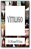Vitiligo (Dermatology)