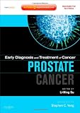 Early Diagnosis and Treatment of Cancer Series: Prostate Cancer: Expert Consult Online and Print (Early Diagnosis in Cancer) Reviews prostate cancer treatment