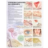 Understanding Allergies Anatomical Chart