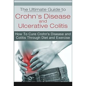 The Ultimate Guide to Crohn's Disease and Ulcerative Colitis: How To Cure Crohn's Disease and Colitis Through Diet and Exercise (Health, IBD, Irritabl