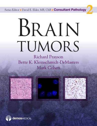 Brain Tumors (Consultant Pathology)
