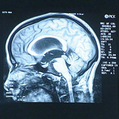 Nervous System: Neurons, Networks, Human Brain DVD