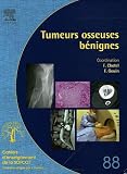 Tumeurs osseuses b�nignes