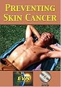 Preventing Skin Cancer DVD
