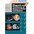 Diagnosis and Treatment of Hepatocellular Carcinoma