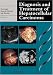 Book Diagnosis and Treatment of Hepatocellular Carcinoma
