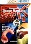 Advances in Tissue Banking