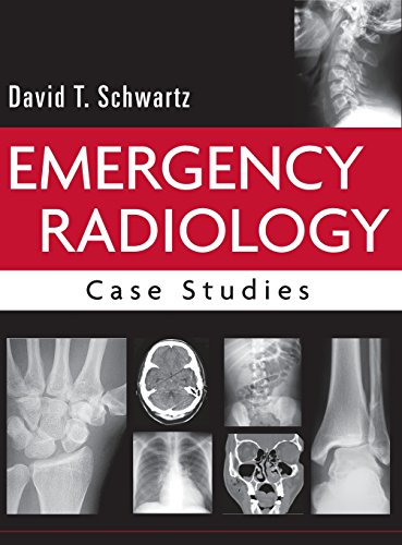 Emergency Radiology: Case Studies, by David Schwartz