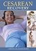 Cesarean Recovery